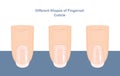 Different Shapes of Fingernail Cuticles. Manicure Guide. Vector