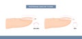 Different Shapes of Nail Plate. Side View. Nail Apex and C-curve. Professional Manicure Guide. Vector
