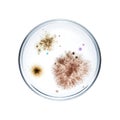 Different types of bacterial colonies in petri dish