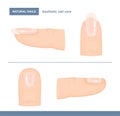 Different Types of Fingernails. Aesthetic Nail Care