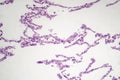 Diffuse emphysema, light micrograph