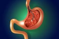 Digestive endoscopy or gastroscopy. Performing a gastroscopy procedure. Diagnostics of gastric diseases. Stomach health.