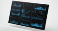 A digital dashboard displaying multiple data visualizations, including line graphs, bar Royalty Free Stock Photo