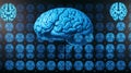 Blue Human Brain with MRI Scan Overlay on Dark Background - Medical Visualization for Research Royalty Free Stock Photo
