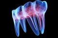Digital illustration of molar tooth in blue colour isolated on black background, 3d render of jaw x-ray with aching tooth, AI Royalty Free Stock Photo