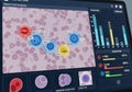 Digital representation of blood cell analysis on a computer screen Royalty Free Stock Photo