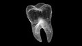 Digital visualization of a human tooth structure in a wireframe design displayed on a black background Royalty Free Stock Photo