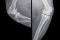 X-ray of the knee of a dog with severe osteoarthritis Royalty Free Stock Photo