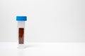 A dipslide culture method for monitoring microbial contaminations in industrial fluids and fuels on a white background. On-site te Royalty Free Stock Photo