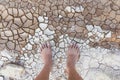 Dirty bare feet on cracked land