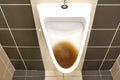 Dirty clogged urinal with water in the toilet of a restaurant. Disinfection and hygiene in toilets of public buildings