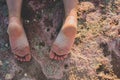 Dirty naked female feet up on the rocks in the summer close-up Royalty Free Stock Photo