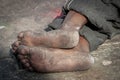 Dirty soles of feet of indian man