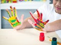 A disabled child in the wheelchair is showing his hands