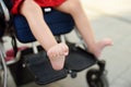 Disabled girl sitting in wheelchair. Close up photo of her legs spasticity muscles . Child cerebral palsy. Disability. Inclusion Royalty Free Stock Photo