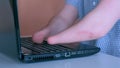 Disabled man with amputated two stump hands is typing on laptop, closeup view.