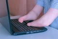 Disabled man with amputated two stump hands work typing on laptop closeup view.