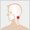 Disease of head and neck. Royalty Free Stock Photo