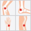 Disease of the joints and bones.