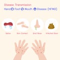 Hand, Foot, and Mouth Disease HFMD Medical Health care concept Royalty Free Stock Photo