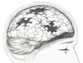 Diseased human brain grey