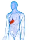 A diseased liver Royalty Free Stock Photo