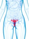 A diseased uterus