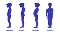 Diseases of the spine. Scoliosis, lordosis, swayback, slouch. Body posture defects. Spinal deformity types. Medical