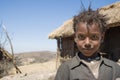 Disheveled young girl posing for a picture, Bale Mountains, Ethiopia