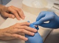 Disinfection of the nail before manicure. The cut in the treatment of the cuticle.