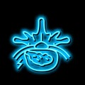 diskectomy patient disease neon glow icon illustration