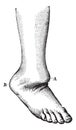 Dislocation of the foot back, vintage engraving