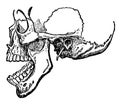 Dislocation of the Lower Jaw, vintage illustration