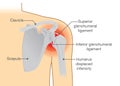 Dislocation Shoulder symptoms or separated.