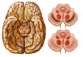 DisminuciÃÂ³n de la dopamina en la enfermedad de Parkinson