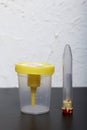Disposable medical polymeric sterile container with a built-in holder for a vacuum test tube with a screw cap. Container for urine