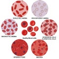 A distinct blood cell morphology against colored backgrounds, Royalty Free Stock Photo