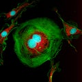 Dividing fibroblast cell