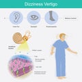 Dizziness Vertigo. Illustration explain dizziness vertigo by cause of crystals can float into the wrong part of the inner ear