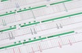 DNA Profile - Genetic Fingerprint