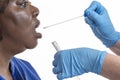 DNA swab of saliva taken from blacl woman