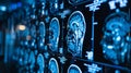 Doctor Analyzing MRI Brain Scans in Hospital