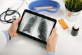 Doctor analyzing patient lung x-ray results on digital tablet