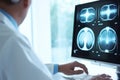 Doctor analyzing patients MRI brain scan computer tomography medical photo x-ray scanner science neurons neurology Royalty Free Stock Photo