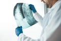 Doctor examining x-ray of the human spine Royalty Free Stock Photo