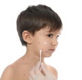 Doctor applying cream onto skin of little boy with chickenpox against background. Varicella zoster virus Royalty Free Stock Photo