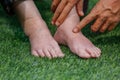 Doctor assessing a elderly swollen foot