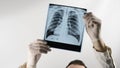 A doctor with a beard looks at an x-ray of a person\'s lungs a medical worker analyzes an x-ray