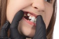 A doctor in black medical gloves examines the oral cavity of a little cute girl. Crooked teeth. Studio photo on a white background