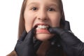 A doctor in black medical gloves examines the oral cavity of a little cute girl. Crooked teeth. Studio photo on a white background